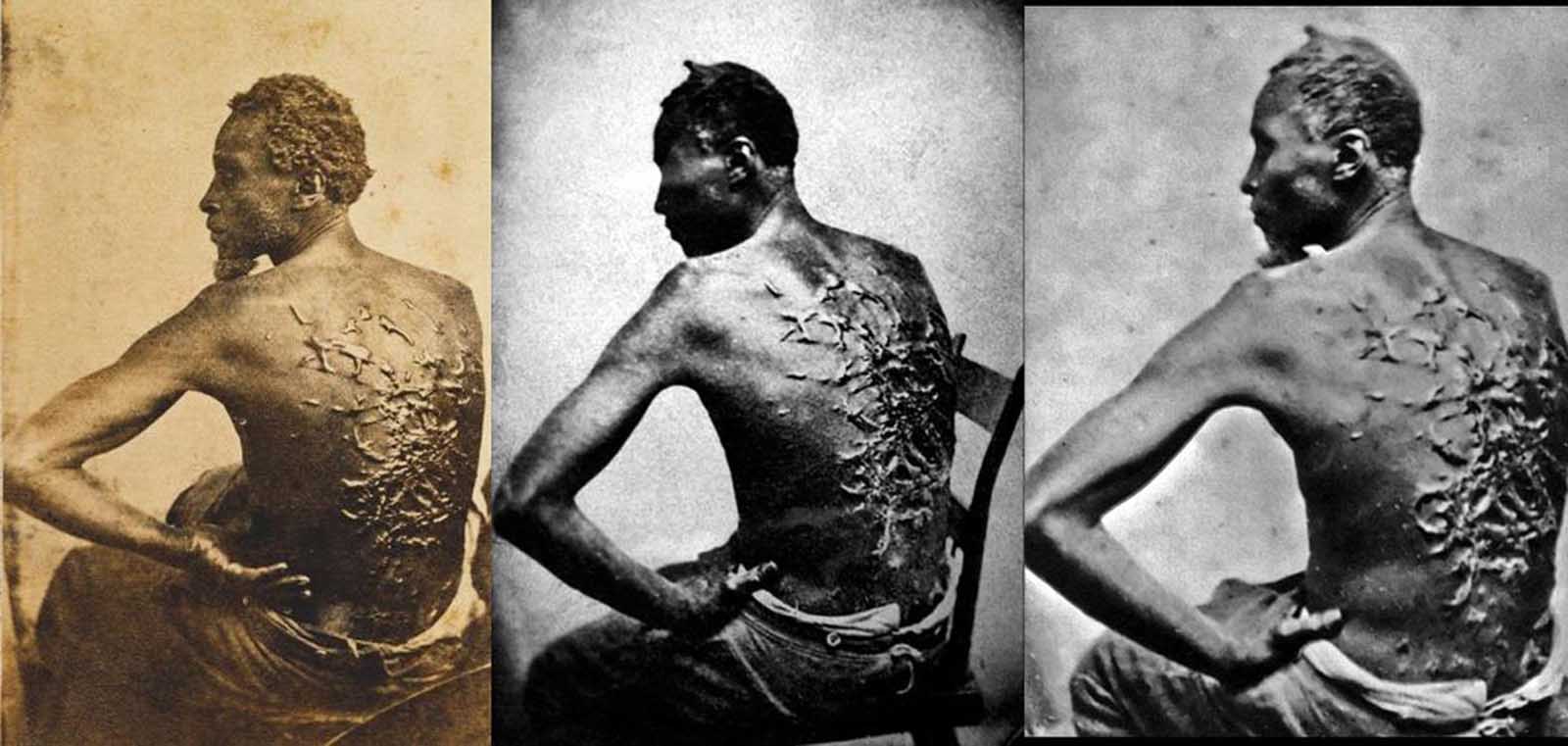 Three different photographs of Peter, a slave from Baton Rouge, Louisiana, ca. 1863. The scars are a result of a whipping by his overseer Artayou Carrier, who was subsequently fired by the master. It took two months to recover from the beating. These photographs were widely distributed in the North during the war. Also called