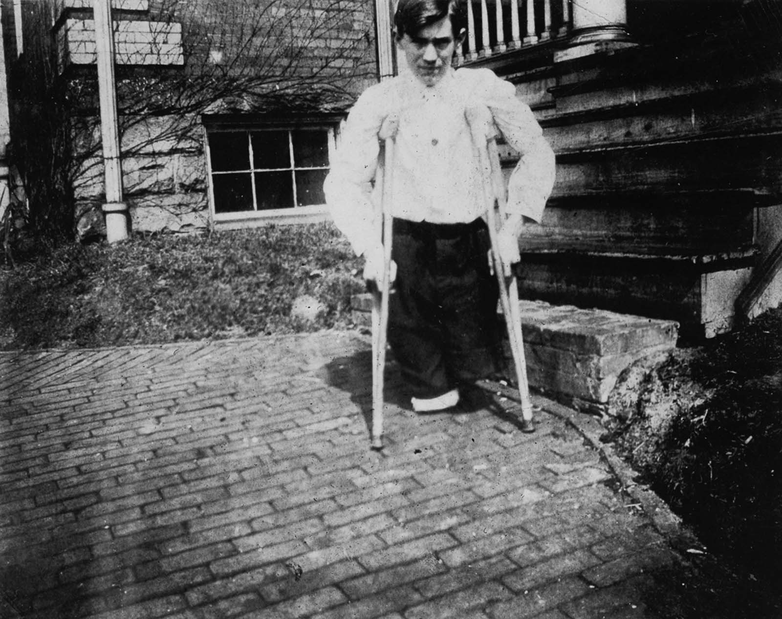 Nola McKinney, whose legs were cut off by a motor car in a coal mine in West Virginia when he was 14 years old. 1910.