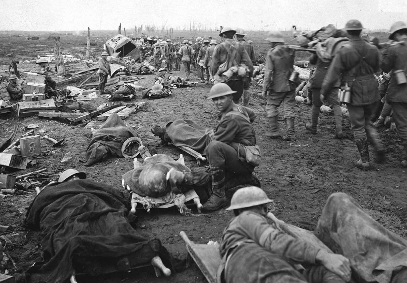 Men wounded in the Ypres battle of September 20th, 1917. Walking along the Menin road, to be taken to the clearing station. German prisoners are seen assisting at stretcher bearing.