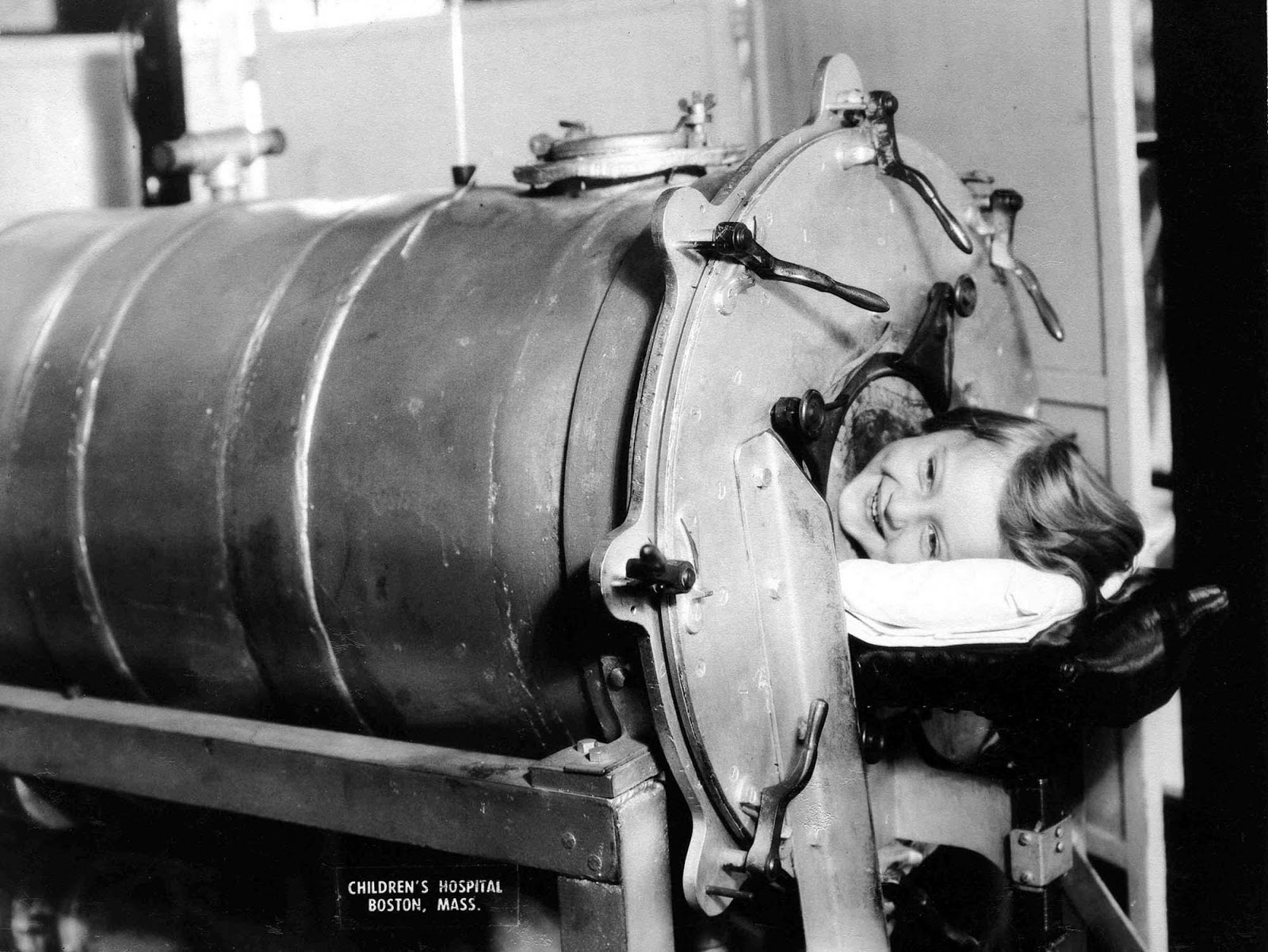 Polio (poliomyelitis) mainly affects children under 5 years of age.