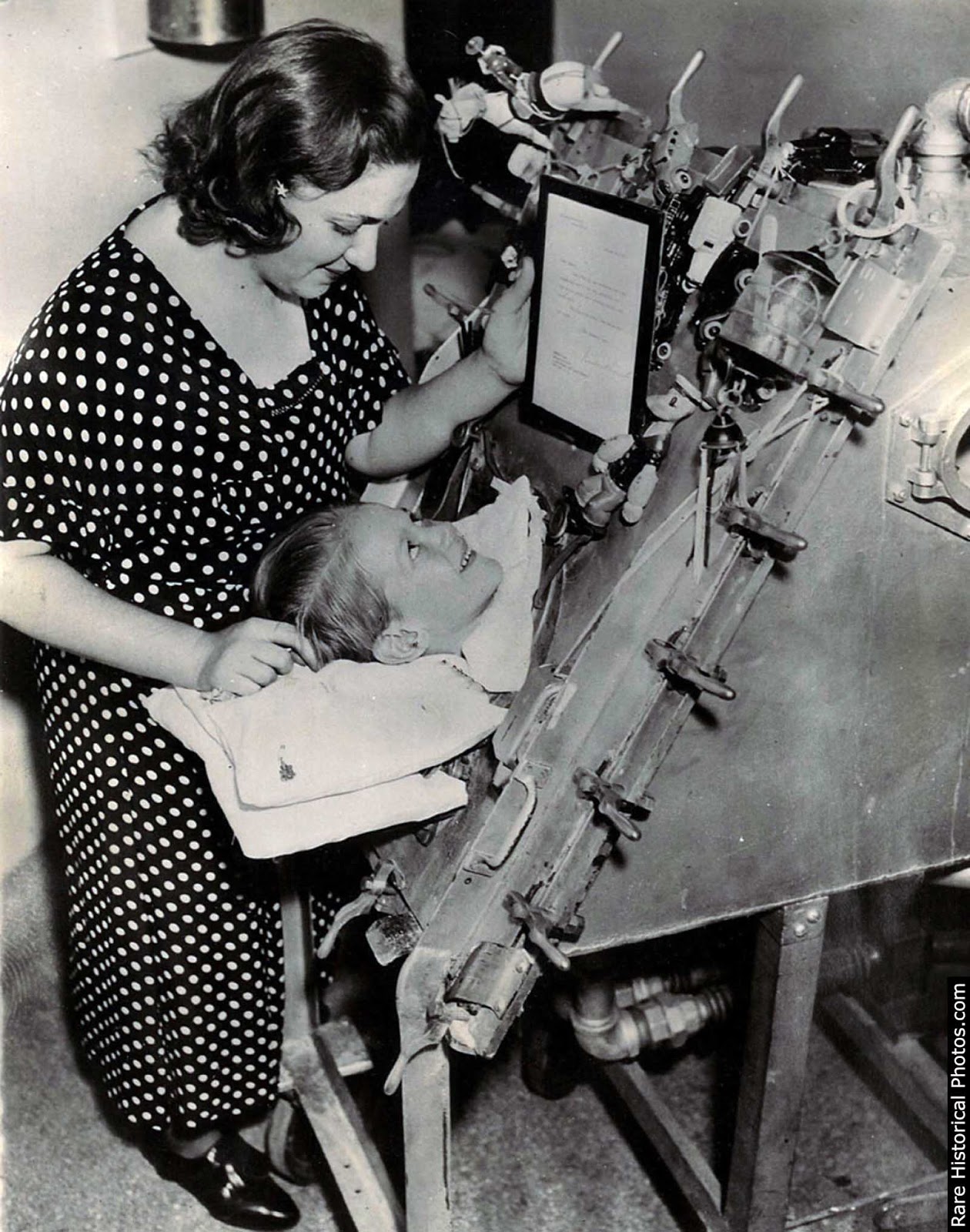 Although the patient could breathe in the machine, he could do little else besides look up at a mirror reflecting the room behind him.