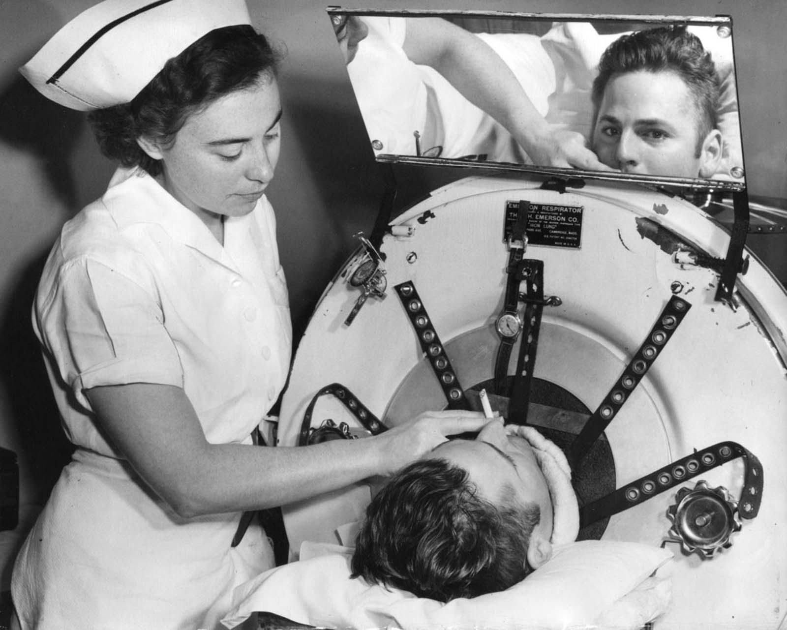 Verne Muskopf, a nurse at St. Anthony's Hospital, South Grand Boulevard and Chippewa Street, helps iron-lung patient Louis Abercrombie smoke a cigarette in November 1949. Abercrombie was a polio patient and had been in an iron lung for almost three years. Hospital policies on smoking were different then.