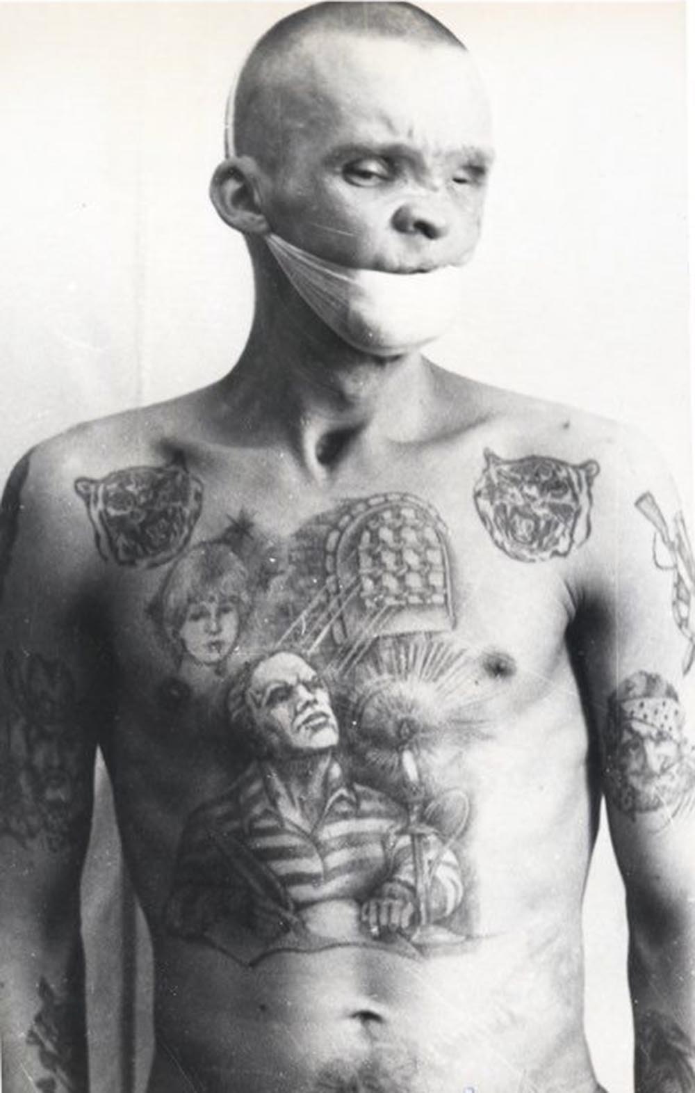 This prisoner is a victim of syphilis and has suffered severe scarring to his face, eyes and mouth. In the prisons and colonies, male or female prisoners suffering from venereal diseases (such as syphilis) are known as 'buketniki,' bouquet holders. They are also nicknamed after army ranks, depending on how advanced their condition is; for example, ‘Kolka whored around without taking any precautions. Yesterday the medic told me that he was already a “lieutenant.