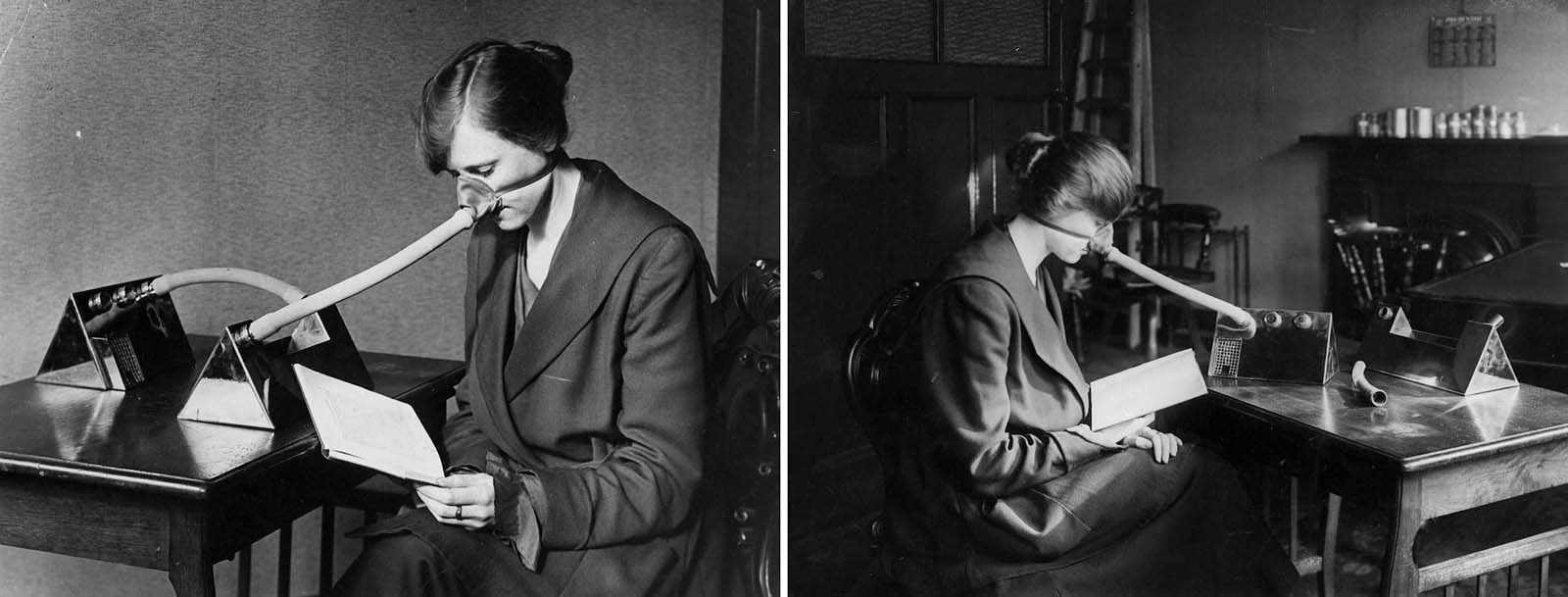 A patient wears a flu nozzle. 1919.