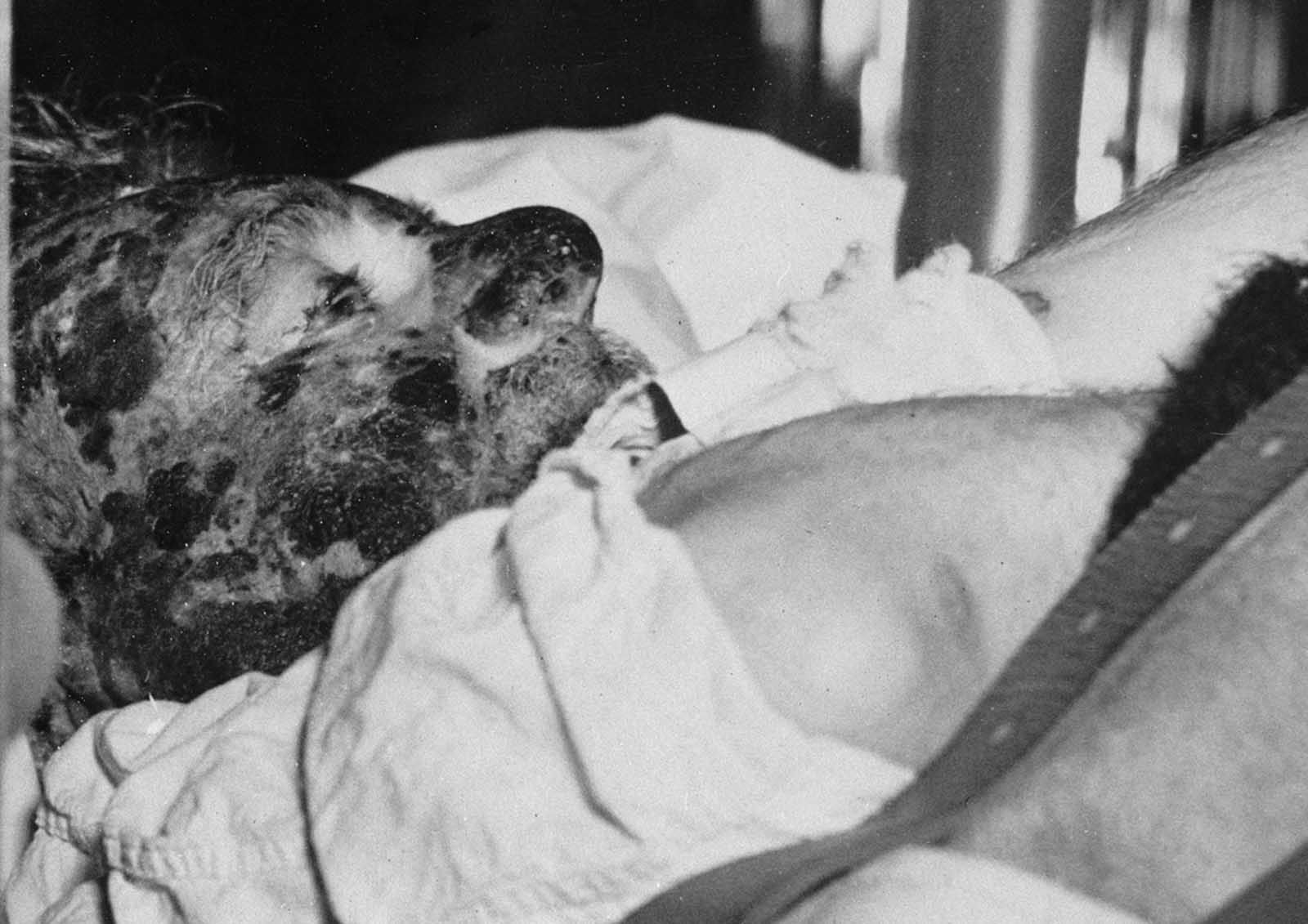 Major Hans Hugo Witt of the German Luftwaffe, who was severely burned in the Hindenburg disaster, is seen as he is transferred from Paul Kimball Hospital in Lakewood, New Jersey, to another area hospital, on May 7, 1937