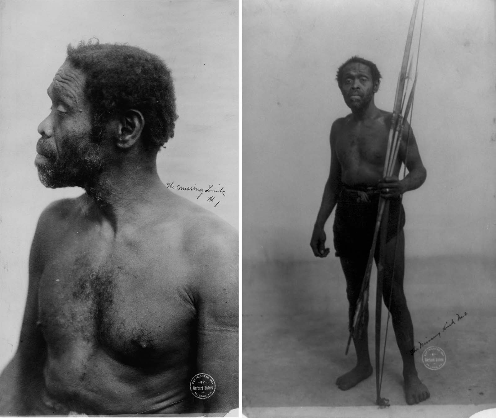 This unidentified African man was cruelly displayed as an exhibit at the 1904 St. Louis World's Fair in Missouri. The words 'the missing link' were scrawled on both of the photos.