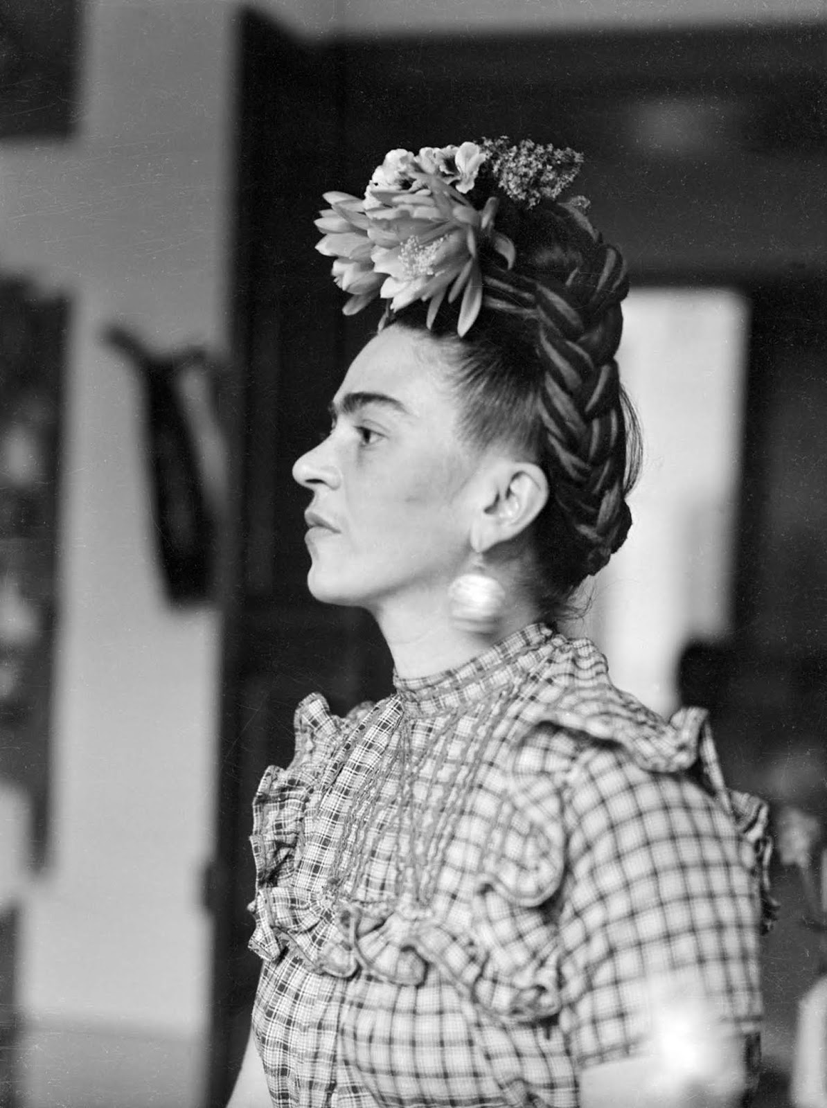 Although she was disabled by polio as a child, Kahlo had been a promising student headed for medical school until a traffic accident at age eighteen, which caused her lifelong pain and medical problems.