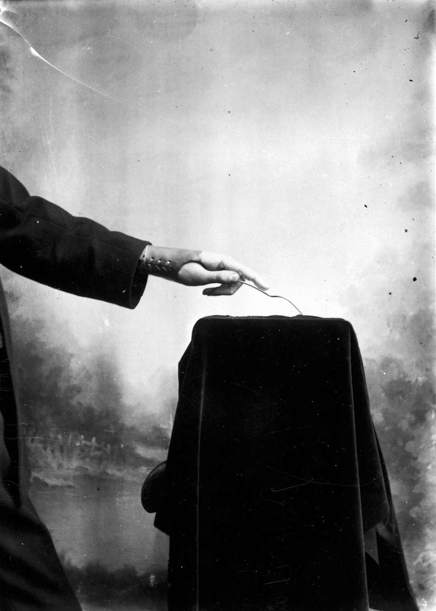 The extraordinary early prostheses made by James Gillingham, 1900