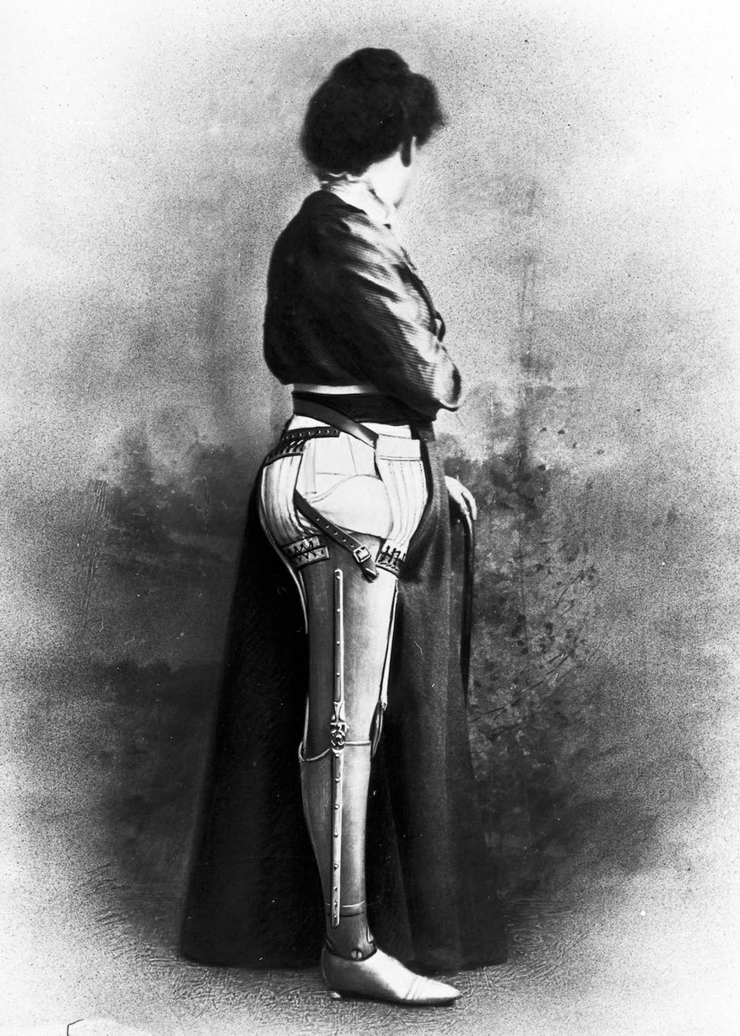 The extraordinary early prostheses made by James Gillingham, 1900