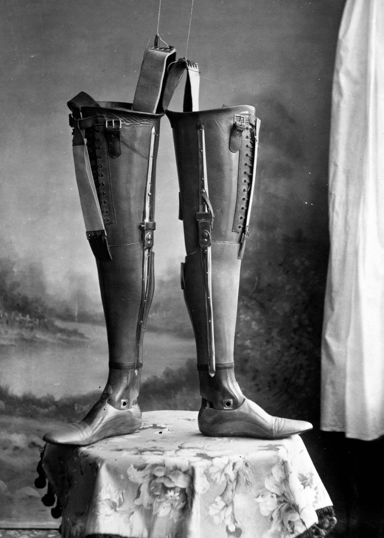 The extraordinary early prostheses made by James Gillingham, 1900