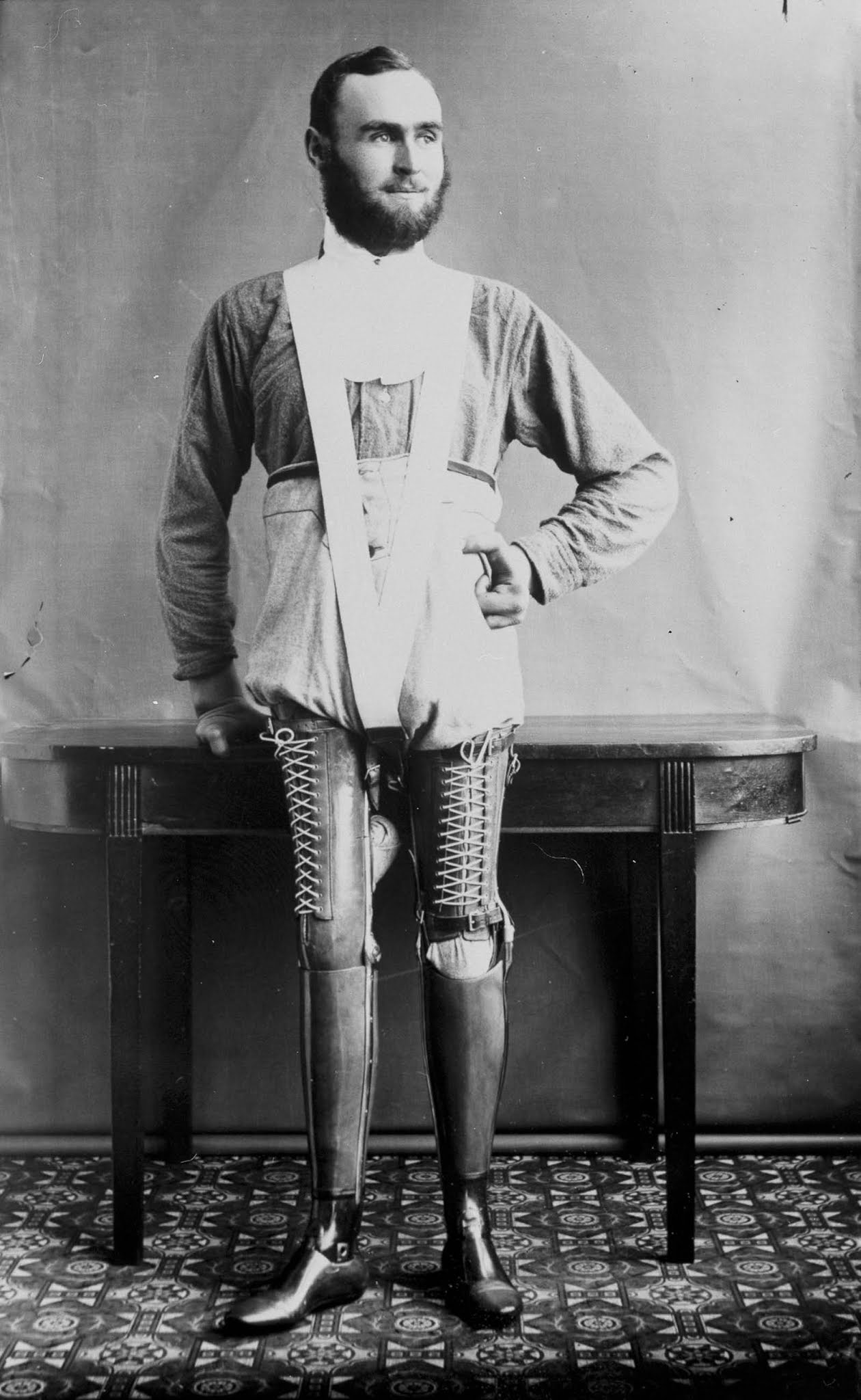 The extraordinary early prostheses made by James Gillingham, 1900