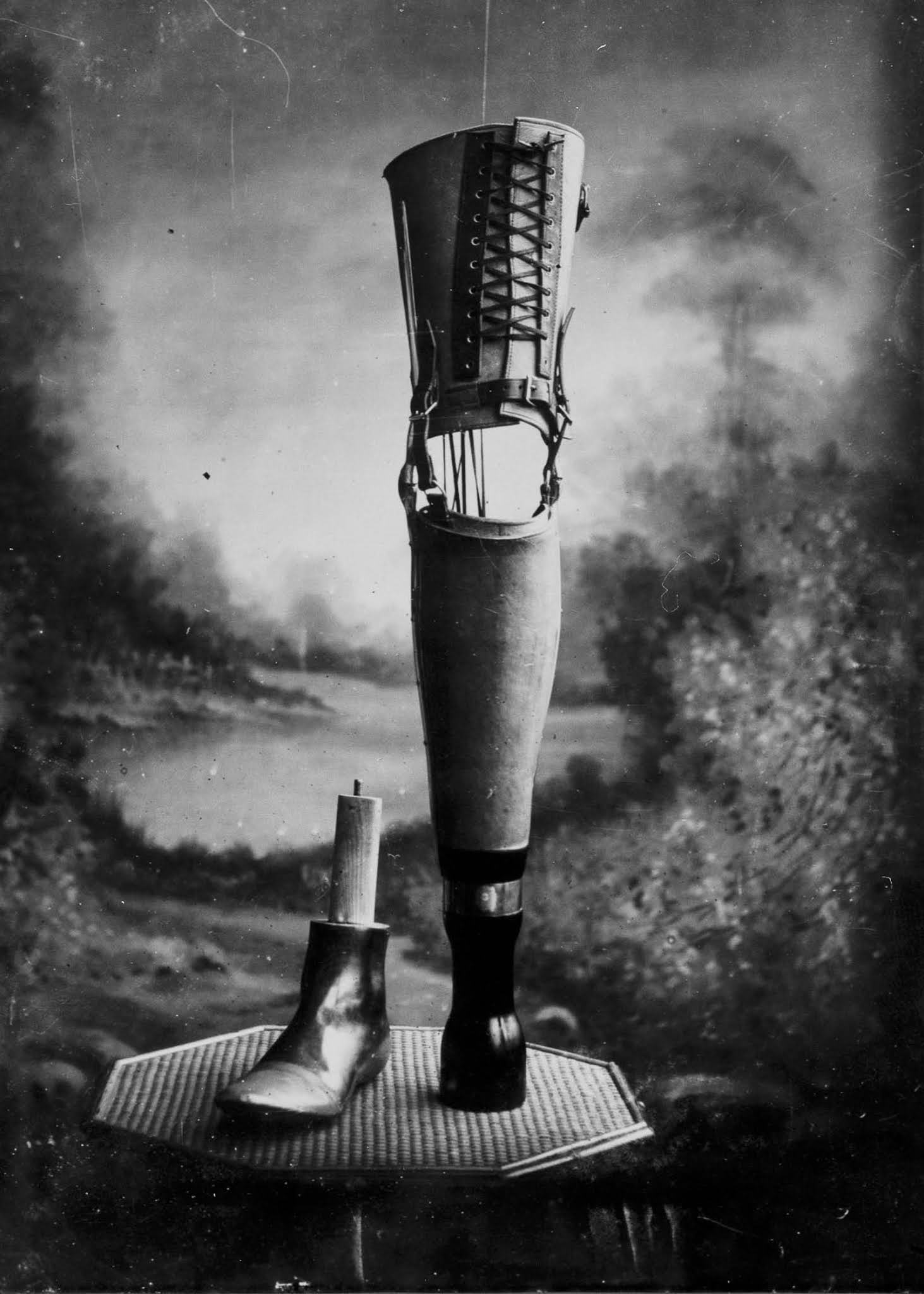 The extraordinary early prostheses made by James Gillingham, 1900