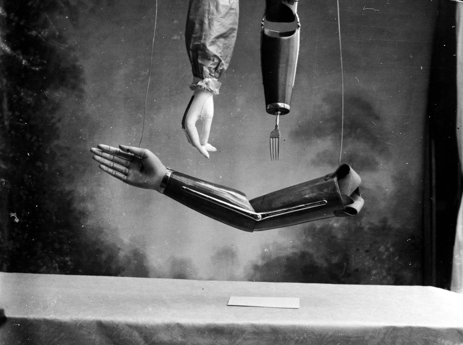 The extraordinary early prostheses made by James Gillingham, 1900