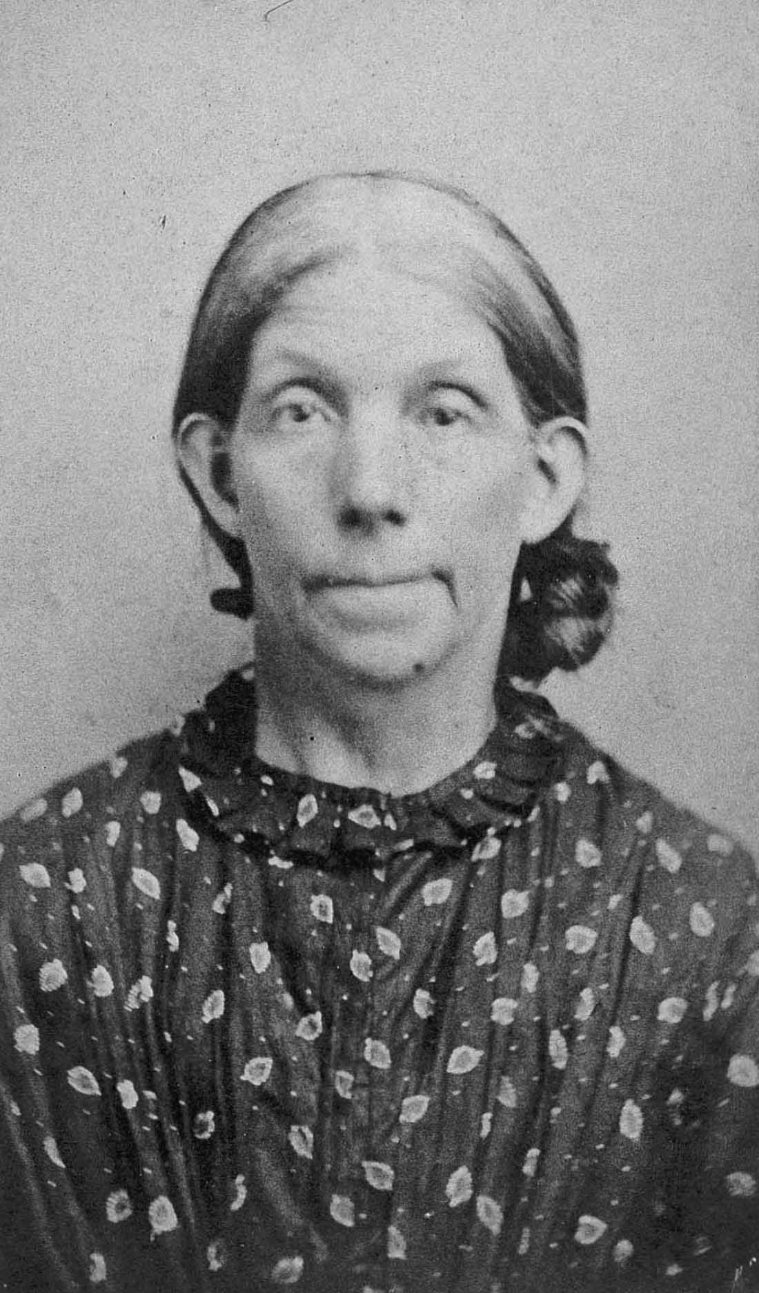 lunatic asylum portraits vintage photos