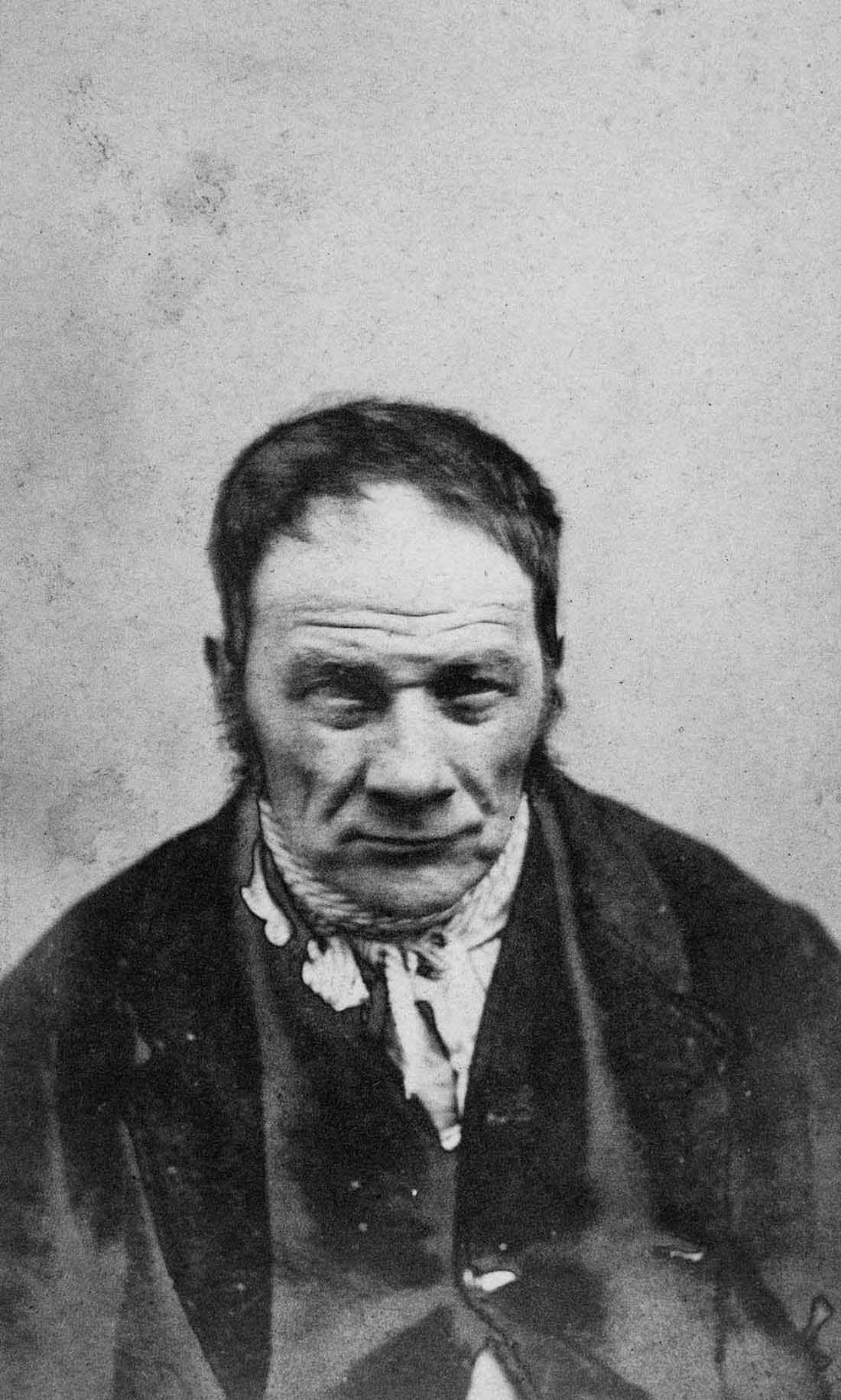 lunatic asylum portraits vintage photos
