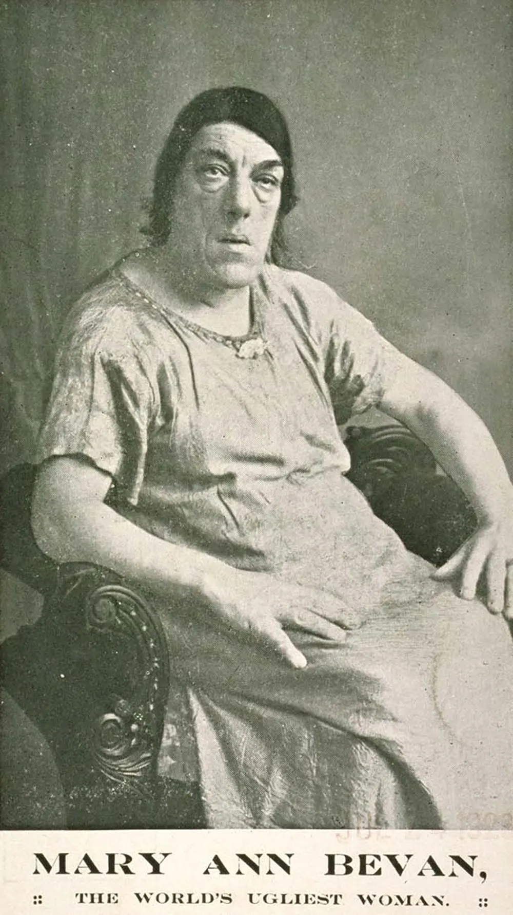 Mary Ann Bevan the Ugliest Woman in the World