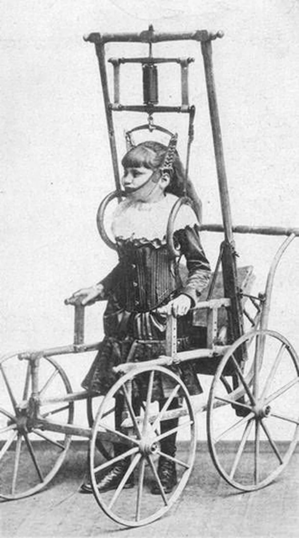 terrifying medical devices from history