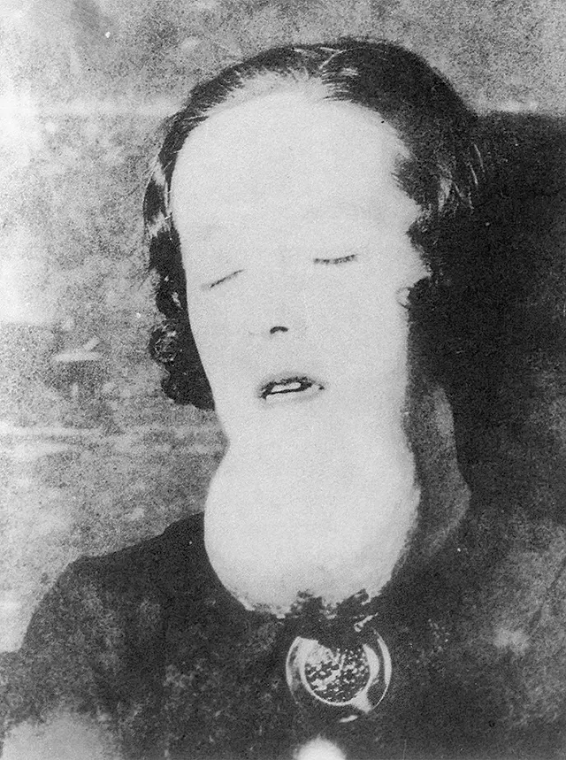 Radium Girls Photos
