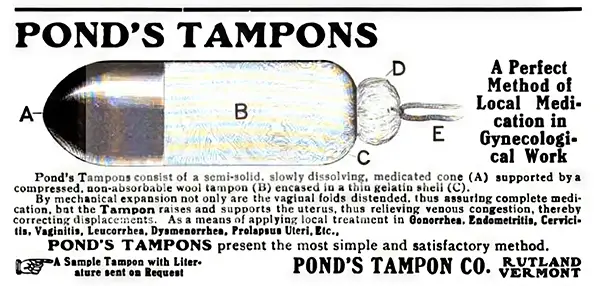 This 1907 advertisement, promoted Pond's tampons as "a perfect method of local medication in gynecological work" and "as a means of applying local treatment in gonorrhea, endometritis, cervicitis".
