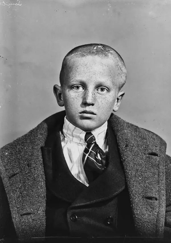 Harvey Cushing Brain Surgery Patients Photos