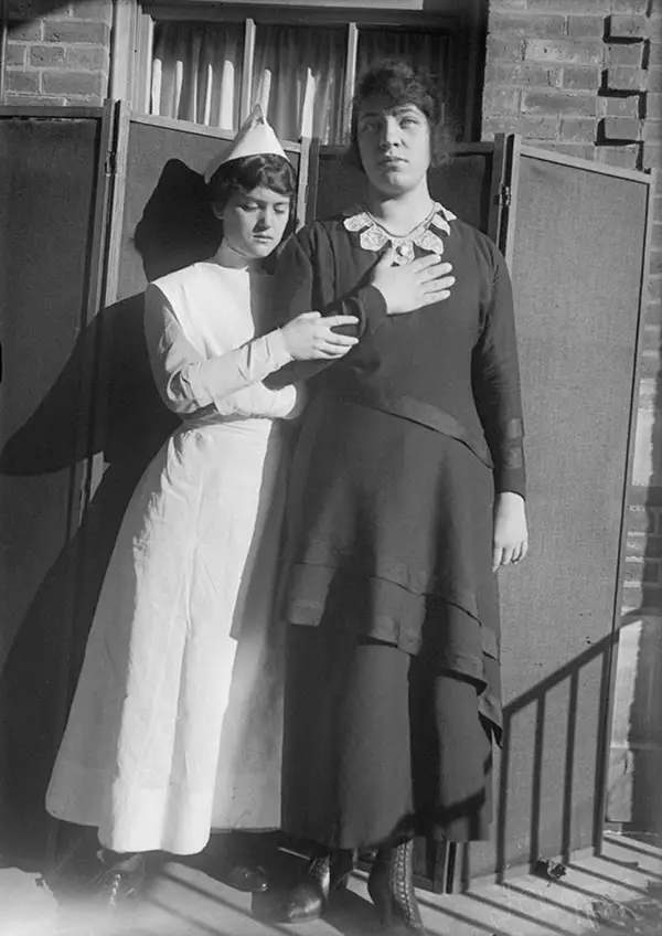 Harvey Cushing Brain Surgery Patients Photos
