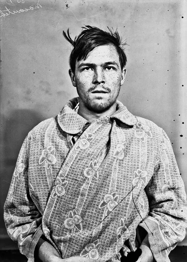 Harvey Cushing Brain Surgery Patients Photos