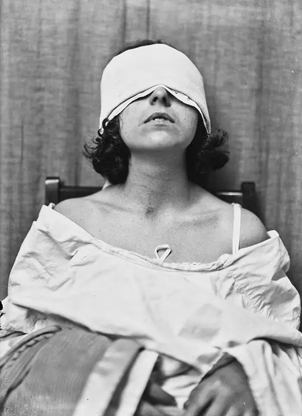 Harvey Cushing Brain Surgery Patients Photos