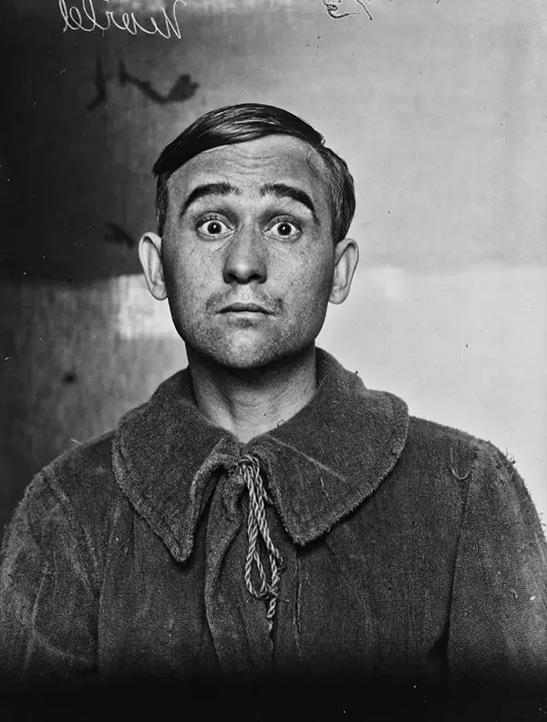 Harvey Cushing Brain Surgery Patients Photos