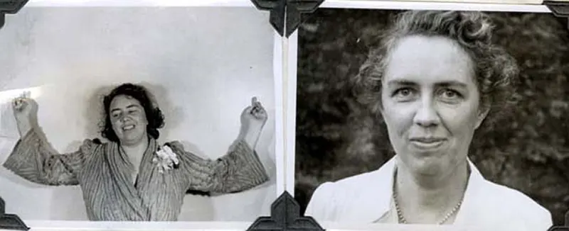 Before and After Lobotomy Photos