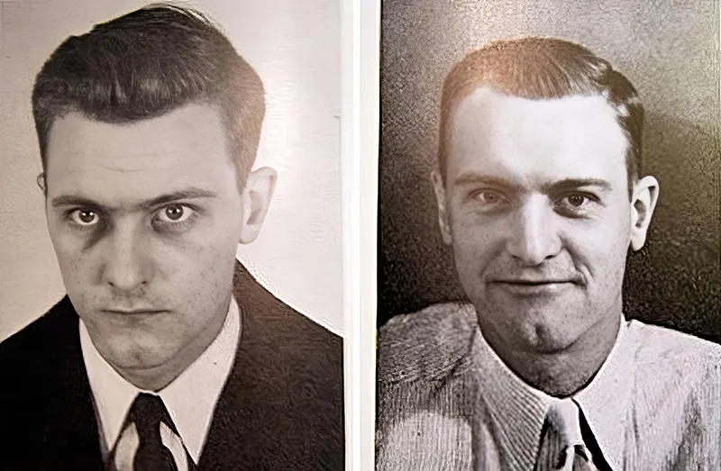 Before and After Lobotomy Photos
