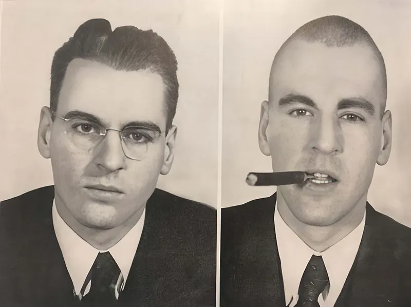 Before and After Lobotomy Photos