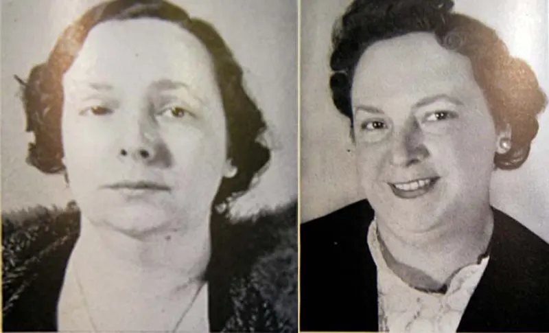 Before and After Lobotomy Photos