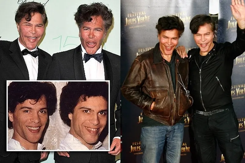 Bogdanoff Twins Transformation Photos