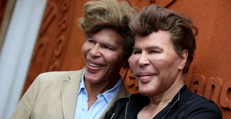 Bogdanoff Twins Transformation Photos