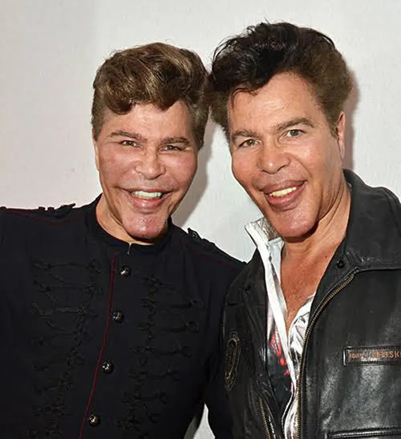 Bogdanoff Twins Transformation Photos