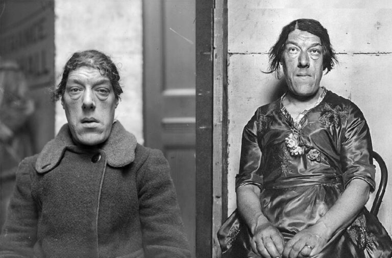 Mary Ann Bevan: The Tragic Story Of The ‘Ugliest Woman In The World’
