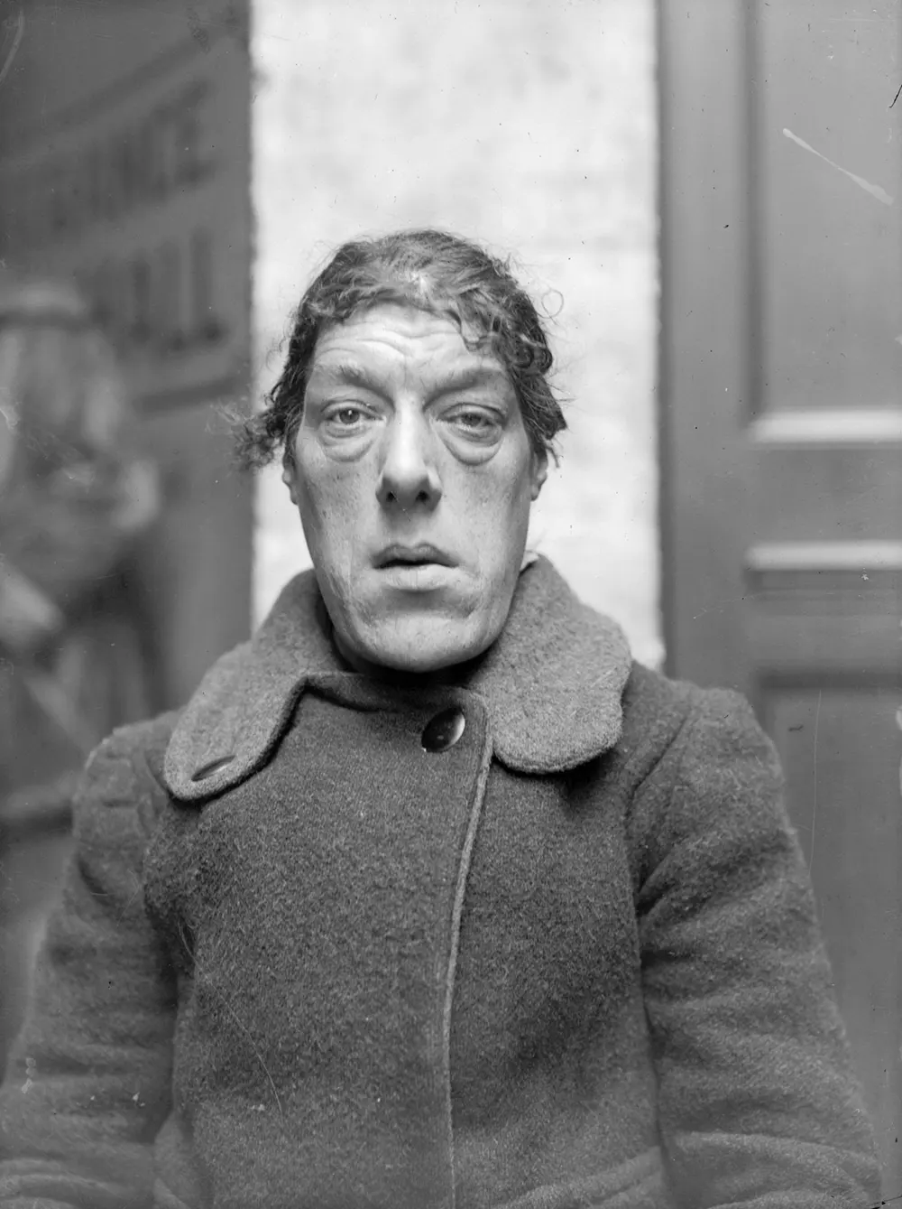 Mary Ann Bevan the Ugliest Woman in the World