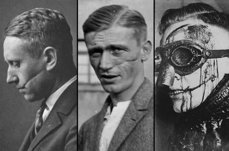 Mensur: Rare Photos of Germany’s Sword-Dueling Tradition Where Facial Scars Meant Honor