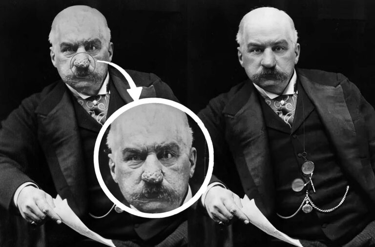 The Story Behind J.P. Morgan’s Large Nose and His Obsession with Retouched Photos